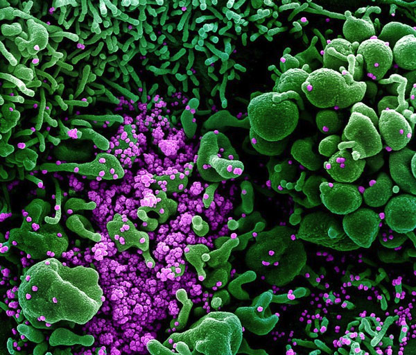 Virus gambar microskop elektron NIAID