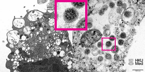 Virus Omicron microskop elektron KHU Med